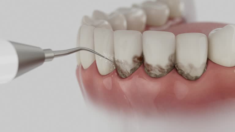 Reliable Dental contractor in Tatum, TX by Smile Center Dentistry